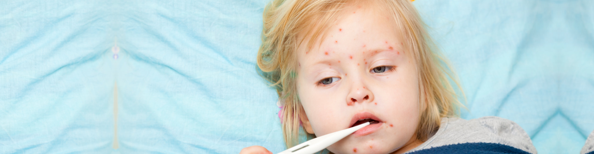 little girl suffering from measles